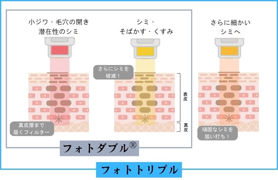 フォトトリプル